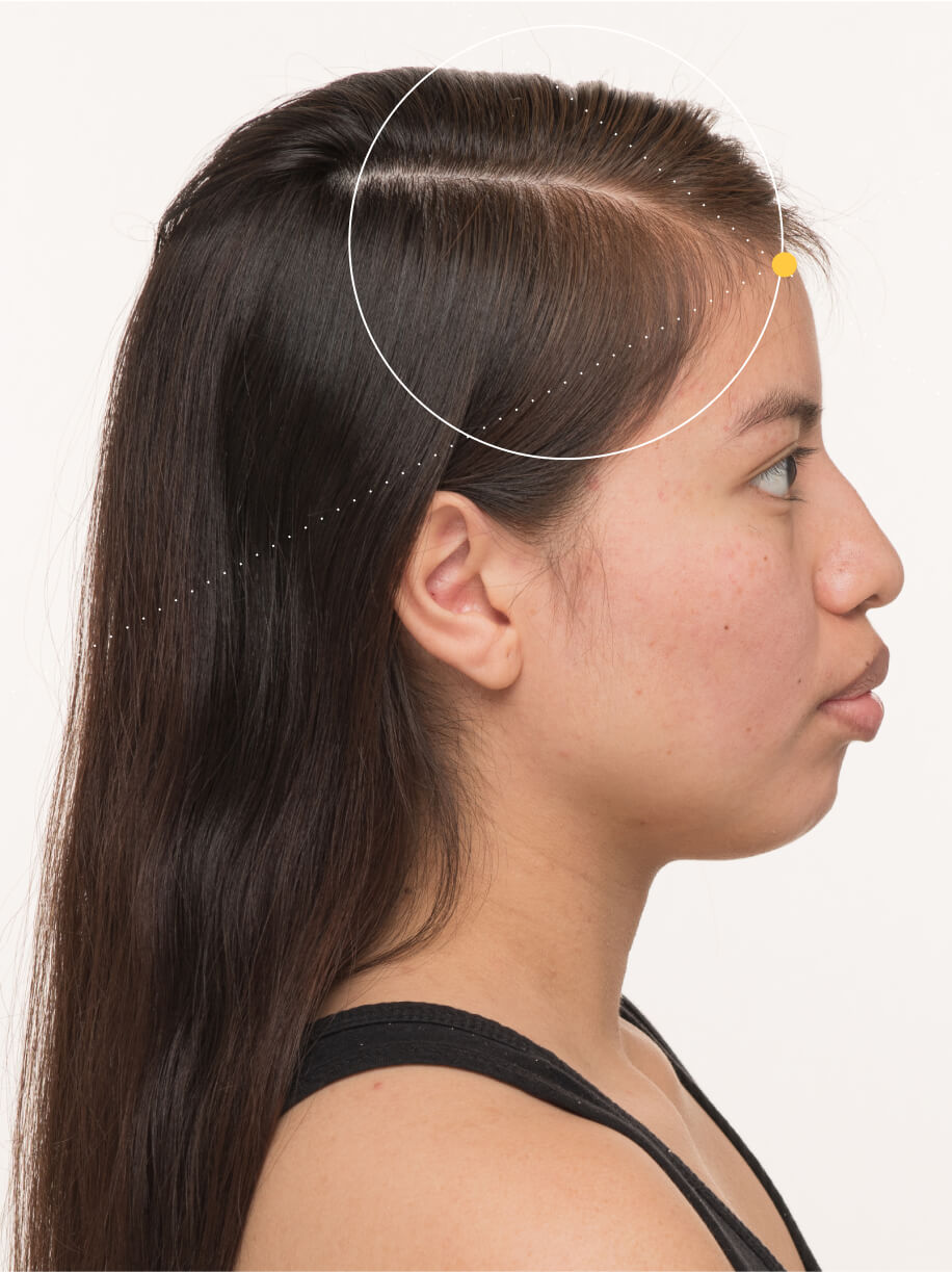 Jessica 3 months into taking Nutrafol Postpartum Hair Growth Nutraceutical. Results are from a clinical study and may vary