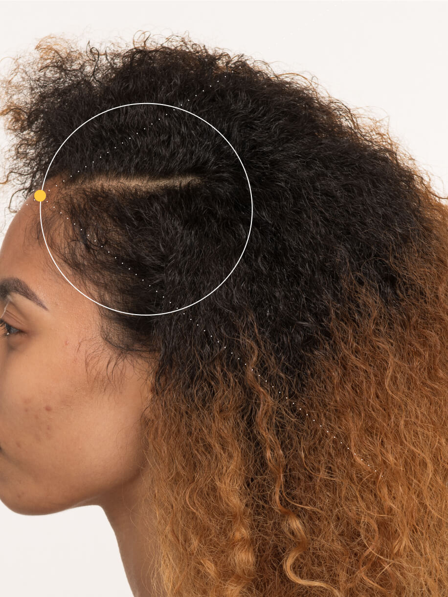 De’yanna 6 months into taking Nutrafol Postpartum Hair Growth Nutraceutical. Results are from a clinical study and may vary